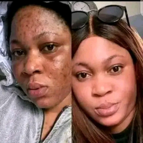 savon-noir-dose-super-eclaircissant-te-debarrasse-de-tout-imperfections-big-1